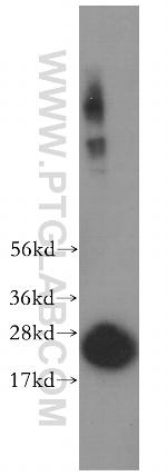 PSMB6 Antibody in Western Blot (WB)