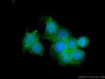 PLEK2 Antibody in Immunocytochemistry (ICC/IF)