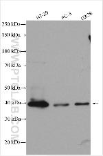 PLEK2 Antibody in Western Blot (WB)