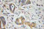 PLEK2 Antibody in Immunohistochemistry (Paraffin) (IHC (P))