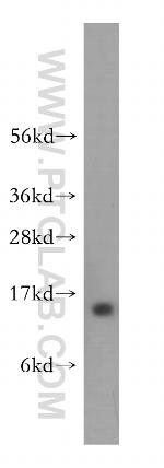 HMGN4 Antibody in Western Blot (WB)