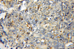 DYNLT3 Antibody in Immunohistochemistry (Paraffin) (IHC (P))
