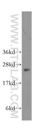 ARL5B Antibody in Western Blot (WB)