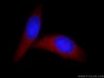 HMGN1 Antibody in Immunocytochemistry (ICC/IF)
