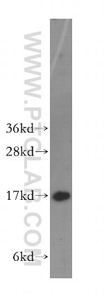 HMGN1 Antibody in Western Blot (WB)