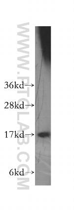 HMGN1 Antibody in Western Blot (WB)