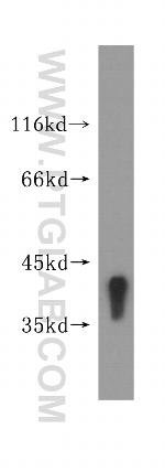 TPST2 Antibody in Western Blot (WB)