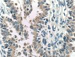 FKBP2 Antibody in Immunohistochemistry (Paraffin) (IHC (P))