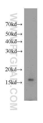 FKBP2 Antibody in Western Blot (WB)