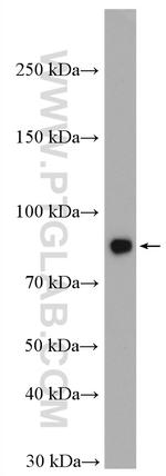 MCM5 Antibody in Western Blot (WB)