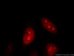 DNAJB6 Antibody in Immunocytochemistry (ICC/IF)
