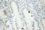 DNAJB6 Antibody in Immunohistochemistry (Paraffin) (IHC (P))