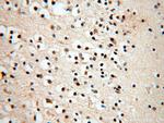 SMN Antibody in Immunohistochemistry (Paraffin) (IHC (P))