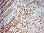 SMN Antibody in Immunohistochemistry (Paraffin) (IHC (P))