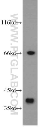 SMN Antibody in Western Blot (WB)