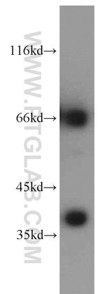 SMN Antibody in Western Blot (WB)