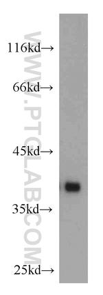 SMN Antibody in Western Blot (WB)