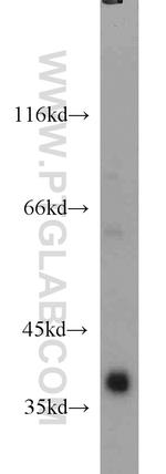 SMN Antibody in Western Blot (WB)