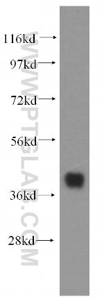 SMN Antibody in Western Blot (WB)