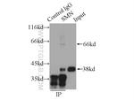 SMN Antibody in Immunoprecipitation (IP)