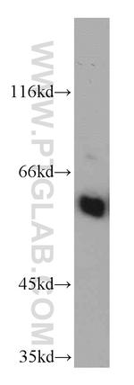 CSN1 Antibody in Western Blot (WB)