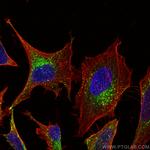 IFITM3 Antibody in Immunocytochemistry (ICC/IF)