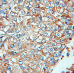 IFITM3 Antibody in Immunohistochemistry (Paraffin) (IHC (P))
