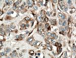 IFITM3 Antibody in Immunohistochemistry (Paraffin) (IHC (P))