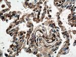 IFITM3 Antibody in Immunohistochemistry (Paraffin) (IHC (P))