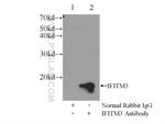 IFITM3 Antibody in Immunoprecipitation (IP)