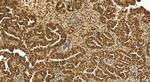 THOC3 Antibody in Immunohistochemistry (Paraffin) (IHC (P))