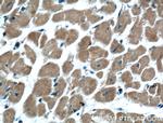 RHOD Antibody in Immunohistochemistry (Paraffin) (IHC (P))