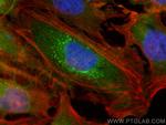 RAB13 Antibody in Immunocytochemistry (ICC/IF)