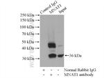 MNAT1 Antibody in Immunoprecipitation (IP)