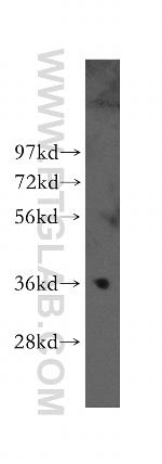 MNAT1 Antibody in Western Blot (WB)