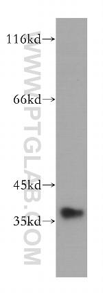 MNAT1 Antibody in Western Blot (WB)
