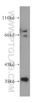 MNAT1 Antibody in Western Blot (WB)