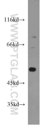 DDX39A Antibody in Western Blot (WB)