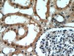 DDX39A Antibody in Immunohistochemistry (Paraffin) (IHC (P))