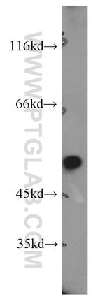 DDX39A Antibody in Western Blot (WB)