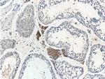 SPOCK2 Antibody in Immunohistochemistry (Paraffin) (IHC (P))