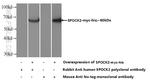 SPOCK2 Antibody in Western Blot (WB)