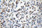 RAD1 Antibody in Immunohistochemistry (Paraffin) (IHC (P))