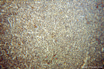 IFITM1 Antibody in Immunohistochemistry (Paraffin) (IHC (P))
