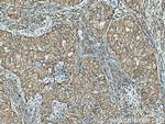 TWF1 Antibody in Immunohistochemistry (Paraffin) (IHC (P))