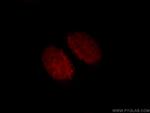 CUX1/Protein CASP Antibody in Immunocytochemistry (ICC/IF)