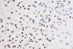 CUX1/Protein CASP Antibody in Immunohistochemistry (Paraffin) (IHC (P))