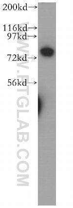 CUX1/Protein CASP Antibody in Western Blot (WB)