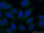 ASB8 Antibody in Immunocytochemistry (ICC/IF)