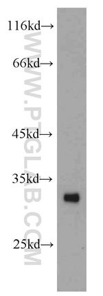 ASB8 Antibody in Western Blot (WB)